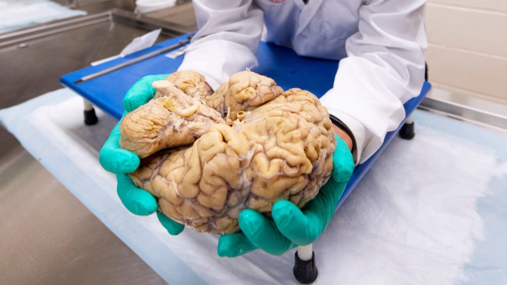 Científicos revelan factores que envejecen el cerebro y reducen su tamaño