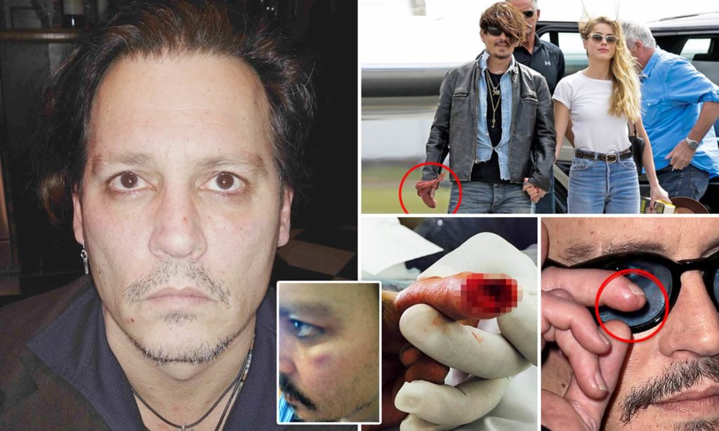 Johnny Depp era golpeado por su ex esposa Amber Heard, se filtra audio