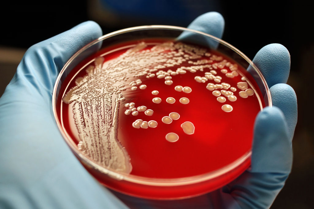 Halacina el nuevo súper antibiótico creado por Inteligencia Artificial