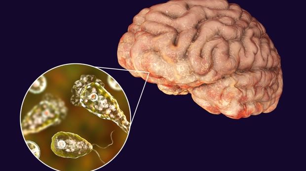 Confirman nuevo caso de la ‘ameba come cerebros’ en Florida