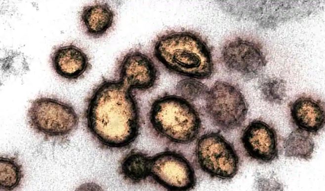 Encuentran la proteína del coronavirus que debilita sistema inmunológico