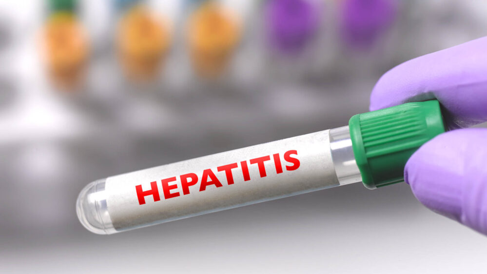 Aumentan casos de hepatitis E por el cambio climático