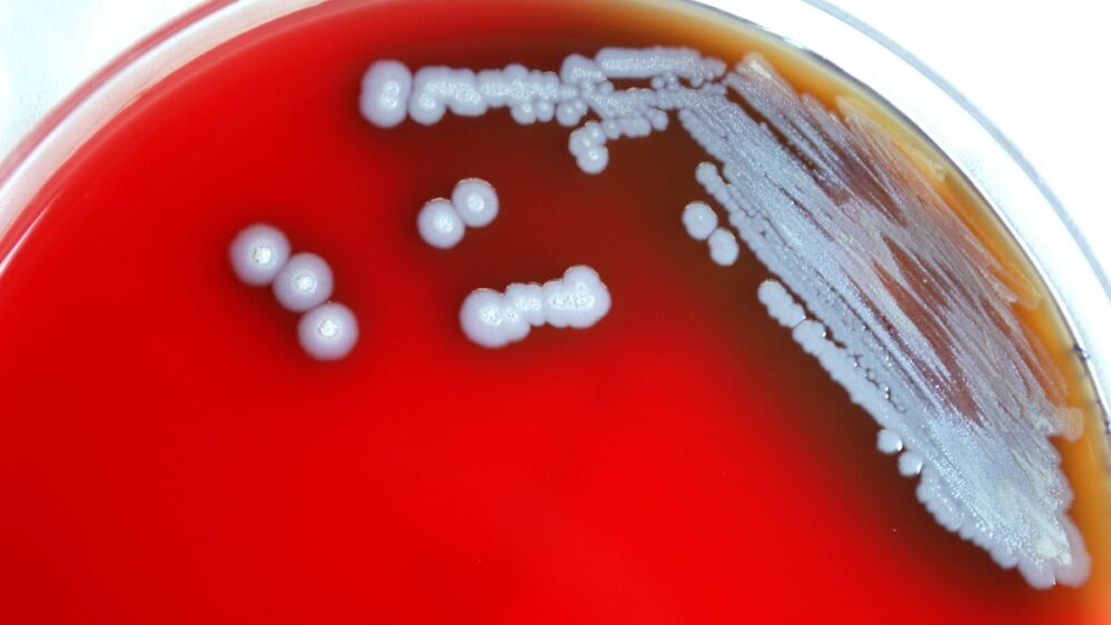 Encuentran peligrosa bacteria en Estados Unidos que preocupa a autoridades de salud