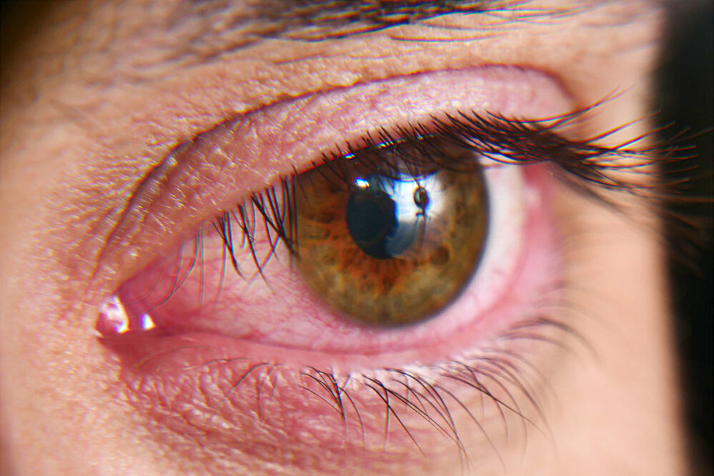 ¡Ojo! Estas tres enfermedades comunes pueden afectar gravemente la visión