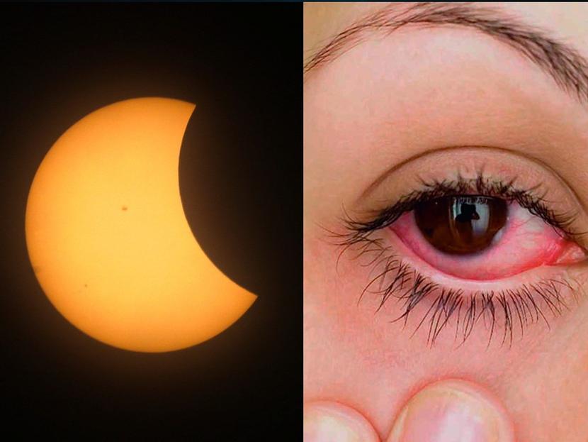 ¿Daño en tus ojos por el eclipse? Aumentan esas búsquedas en Google