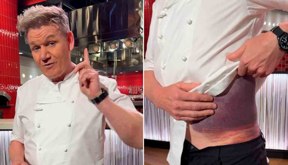 El chef Gordon Ramsay revela aparatoso accidente en bicicleta y muestra la grave lesión