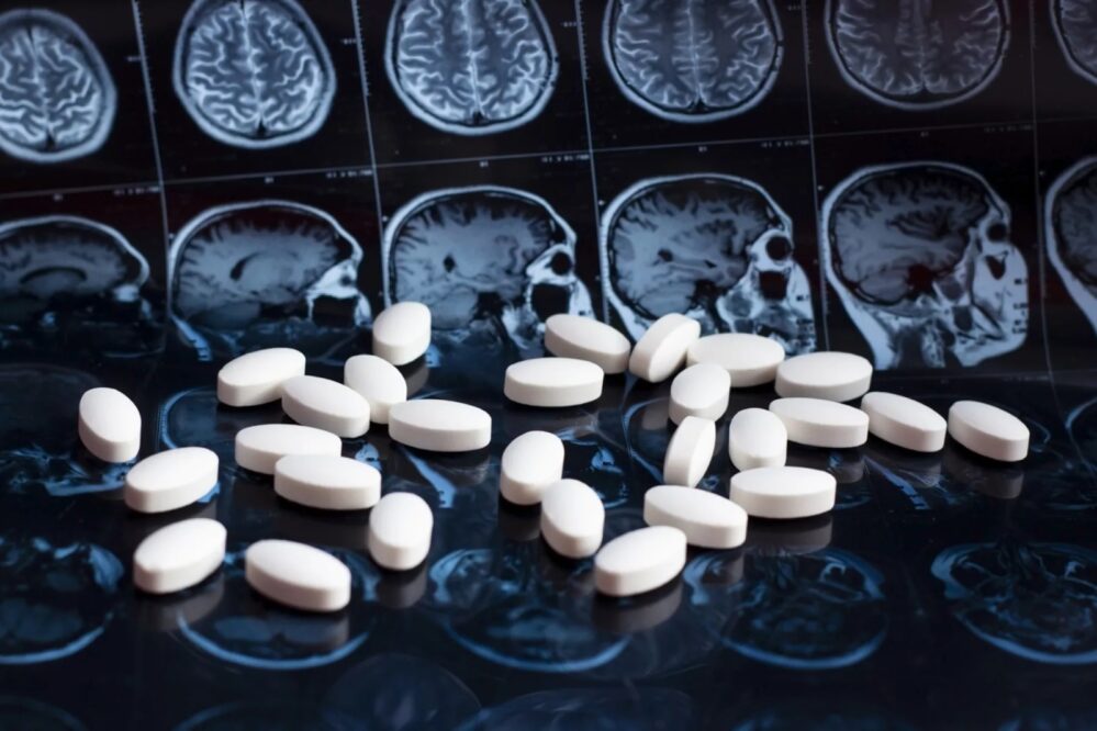 En Estados Unidos FDA aprueba medicamento que retrasa el avance del Alzheimer
